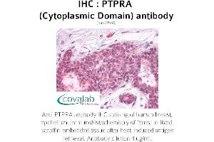 Image no. 1 for anti-Protein tyrosine Phosphatase, Receptor Type, A (PTPRA) antibody (ABIN1738604)