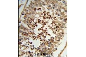 Formalin-fixed and paraffin-embedded human testis tissue reacted with TAC2N Antibody (N-term), which was peroxidase-conjugated to the secondary antibody, followed by DAB staining. (TC2N Antikörper  (N-Term))