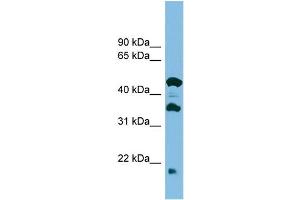 WB Suggested Anti-C11orf73 Antibody Titration: 0. (C11orf73 Antikörper  (Middle Region))