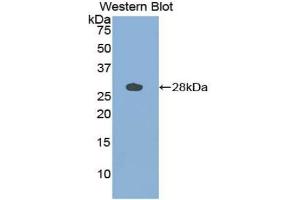 Detection of Recombinant CTSS, Bovine using Polyclonal Antibody to Cathepsin S (CTSS) (Cathepsin S Antikörper  (AA 115-331))