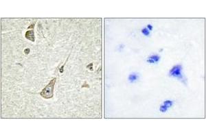 Immunohistochemistry analysis of paraffin-embedded human brain tissue, using PCDH-X/Y Antibody. (PCDH-X/Y (AA 531-580) Antikörper)