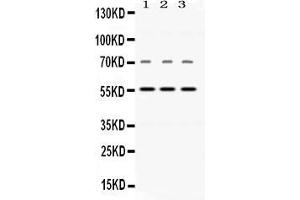 Western blot analysis of Visfatin expression in rat brain extract ( Lane 1), mouse cardiac muscle extract ( Lane 2), and human placenta extract ( Lane 3). (NAMPT Antikörper  (AA 62-337))