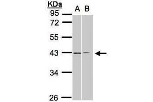 WB Image Sample(30 ug whole cell lysate) A:293T B:H1299 10% SDS PAGE antibody diluted at 1:1000 (GALR2 Antikörper  (C-Term))