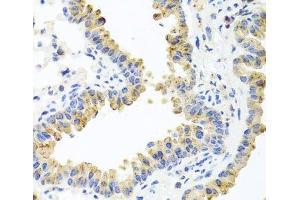 Immunohistochemistry of paraffin-embedded Mouse lung using HSPA6 Polyclonal Antibody at dilution of 1:100 (40x lens). (HSPA6 Antikörper)