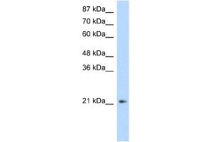 WB Suggested Anti-FERD3L Antibody Titration:  1. (FERD3L Antikörper  (N-Term))