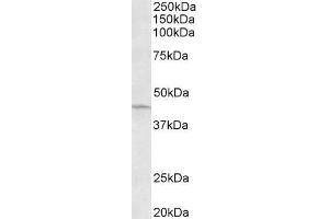 Western Blotting (WB) image for anti-Actin Related Protein 2/3 Complex, Subunit 1A, 41kDa (ARPC1A) (C-Term) antibody (ABIN5539619)