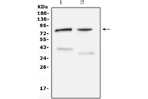 anti-Choline O-Acetyltransferase (CHAT) (AA 446-652) antibody