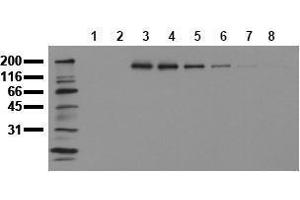 Western Blotting (WB) image for anti-Receptor tyrosine-protein kinase erbB-2 (ErbB2/Her2) (pTyr1112) antibody (ABIN126789) (ErbB2/Her2 Antikörper  (pTyr1112))