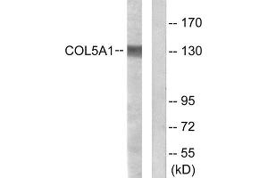 Western Blotting (WB) image for anti-Collagen, Type V, alpha 1 (COL5A1) (Internal Region) antibody (ABIN1850288) (COL5A1 Antikörper  (Internal Region))
