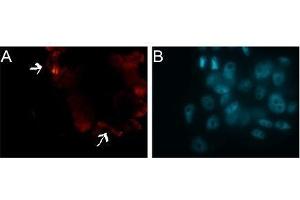 Immunofluorescence (IF) image for anti-Tubulin, beta (TUBB) antibody (ABIN619536) (TUBB Antikörper)