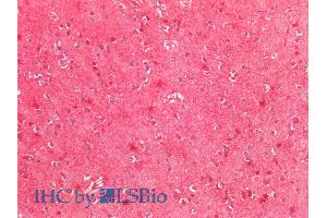 ABIN768567 (5µg/ml) staining of paraffin embedded Human Cortex. (SOD2 Antikörper  (Internal Region))