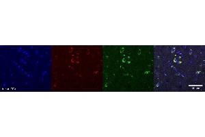 Immunohistochemistry (IHC) image for anti-Oligodendrocytic Myelin Paranodal and Inner Loop Protein (OPALIN) antibody (ABIN7456149) (OPALIN Antikörper)