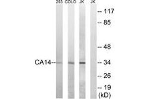 Western Blotting (WB) image for anti-Carbonic Anhydrase XIV (CA14) (AA 161-210) antibody (ABIN2890187) (CA14 Antikörper  (AA 161-210))