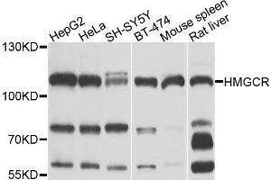 Western blot analysis of extracts of various cells, using HMGCR antibody. (HMGCR Antikörper)