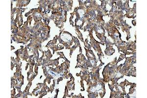 IHC analysis of EEF2 using anti-EEF2 antibody (ABIN7599561).