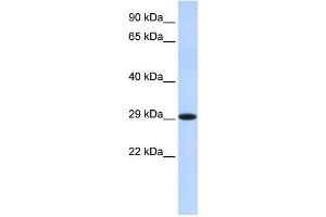 Western Blotting (WB) image for anti-Hydroxysteroid (17-Beta) Dehydrogenase 14 (HSD17B14) antibody (ABIN2459984) (HSD17B14 Antikörper)