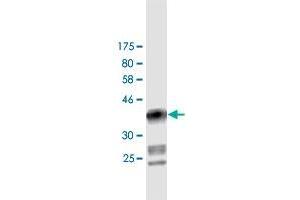 Western Blot detection against Immunogen (37. (DIAPH1 Antikörper  (AA 921-1024))