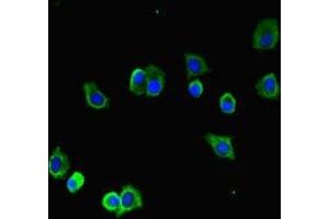 Immunofluorescent analysis of HepG2 cells using ABIN7173655 at dilution of 1:100 and Alexa Fluor 488-congugated AffiniPure Goat Anti-Rabbit IgG(H+L) (TUBA1B Antikörper  (AA 29-310))