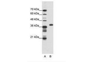 Image no. 1 for anti-Poly(rC) Binding Protein 1 (PCBP1) (AA 201-250) antibody (ABIN202334) (PCBP1 Antikörper  (AA 201-250))