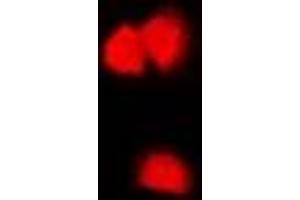 Immunofluorescent analysis of CASK staining in U2OS cells. (CASK Antikörper)