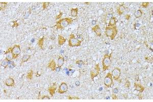 Immunohistochemistry of paraffin-embedded Mouse brain using EIF2B2 Polyclonal Antibody at dilution of 1:100 (40x lens). (EIF2B2 Antikörper)
