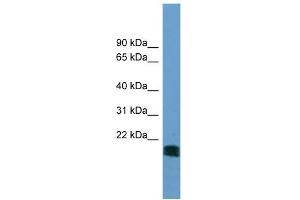 WB Suggested Anti-NT5M Antibody Titration: 0.