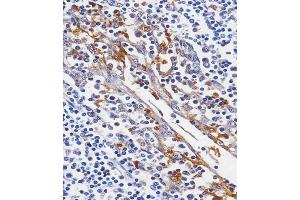 C staining LYZ in human tonsil tissue sections by Immunohistochemistry (IHC-P - paraformaldehyde-fixed, paraffin-embedded sections). (LYZ Antikörper  (C-Term))