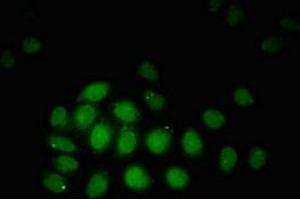 Immunofluorescent analysis of A549 cells using ABIN7172775 at dilution of 1:100 and Alexa Fluor 488-congugated AffiniPure Goat Anti-Rabbit IgG(H+L)