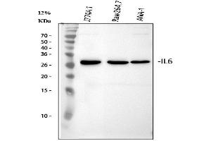 anti-Interleukin 6 (IL6) (AA 25-211) antibody
