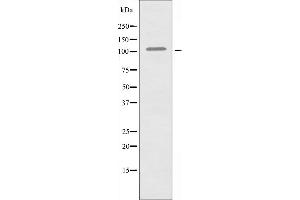 Western blot analysis of extracts from COLO205 cells, using EPHA1 antibody. (EPHA1 Antikörper  (Internal Region))