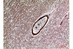 Immunohistochemistry (IHC) analysis of paraffin-embedded Human Brain, antibody was diluted at 1:100. (DKK1 Antikörper  (Internal Region))