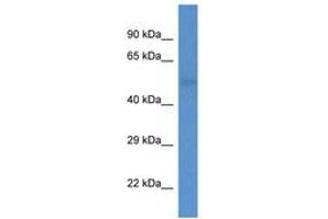 Image no. 1 for anti-1-Acylglycerol-3-Phosphate O-Acyltransferase 6 (Lysophosphatidic Acid Acyltransferase, Zeta) (AGPAT6) (AA 209-258) antibody (ABIN6746911) (AGPAT6 Antikörper  (AA 209-258))