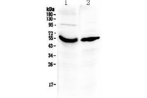 Western blot analysis of Vitamin D Binding protein using anti-Vitamin D Binding protein antibody . (Gc (AA 17-256) Antikörper)