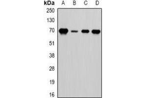 Western blot analysis of LTA4H expression in HepG2 (A), Romas (B), mouse spleen (C), mouse brain (D) whole cell lysates. (LTA4H Antikörper)