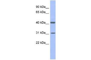 WB Suggested Anti-GAPDHS Antibody Titration:  0. (GAPDHS Antikörper  (N-Term))