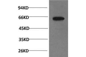 Western Blot analysis of PC-3 cells using Phospho-AKT1 (Ser473) Monoclonal Antibody at dilution of 1:1000 (AKT1 Antikörper  (pSer473))