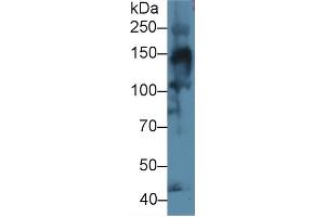 Western Blot; Sample: Mouse Skeletal muscle lysate; Primary Ab: 1µg/ml Rabbit Anti-Human COL4a3 Antibody Second Ab: 0.