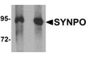 Western blot analysis of SYNPO in Rat brain tissue lysate with SYNPO antibody at (left) 1 and (right) 2 μg/ml.