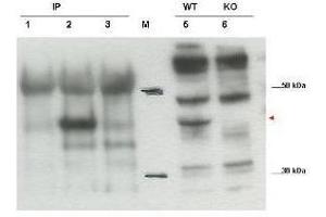 Western blot using  affinity purified anti-Cybr antibody shows detection of endogenous Cybr from mouse splenocytes using anti-Cybr antibody to immunoprecipitate and western blot (lanes 1-3). (CYTIP Antikörper  (C-Term))