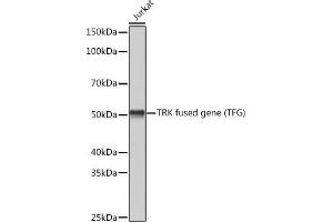Western blot analysis of extracts of Jurkat cells, using TRK fused gene (TFG) (TFG) Rabbit mAb (ABIN1512690, ABIN3022090, ABIN3022091 and ABIN7101442) at 1:3000 dilution. (TFG Antikörper)