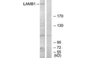 Western blot analysis of extracts from HepG2 cells, using LAMB1 Antibody. (Laminin beta 1 Antikörper  (AA 1721-1770))