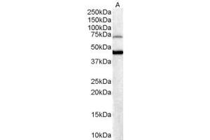 ABIN184820 (0. (FOXG1 Antikörper  (C-Term))