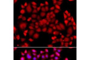 Immunofluorescence analysis of A549 cells using PIP4K2B Polyclonal Antibody (PIP4K2B Antikörper)