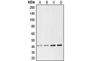 Western blot analysis of CMKLR1 expression in Jurkat (A), HepG2 (B), mouse liver (C), rat liver (D) whole cell lysates. (CMKLR1 Antikörper  (Center))