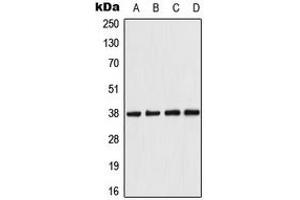 Western blot analysis of AMPK beta 1 expression in HeLa (A), Raw264. (PRKAB1 Antikörper  (N-Term))