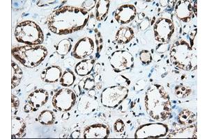 Immunohistochemical staining of paraffin-embedded Human thyroid tissue using anti-IGF2BP2 mouse monoclonal antibody.