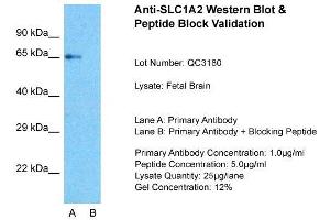 Host:  Rabbit  Target Name:  SLC1A2  Sample Type:  Fetal Brain  Lane A:  Primary Antibody  Lane B:  Primary Antibody + Blocking Peptide  Primary Antibody Concentration:  1ug/ml  Peptide Concentration:  5ug/ml  Lysate Quantity:  25ug/lane/Lane  Gel Concentration:  0. (SLC1A2 Antikörper  (N-Term))