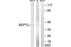 Western blot analysis of extracts from Jurkat/MCF-7 cells, using SEPT2 Antibody. (Septin 2 Antikörper  (AA 103-152))