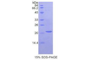 SDS-PAGE (SDS) image for Cathepsin L1 (CTSL1) (AA 114-288) protein (His tag) (ABIN1170046) (Cathepsin L Protein (AA 114-288) (His tag))