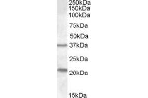 ABIN334520 (1µg/ml) staining of Human Liver lysate (35µg protein in RIPA buffer). (TUSC3 Antikörper  (Internal Region))